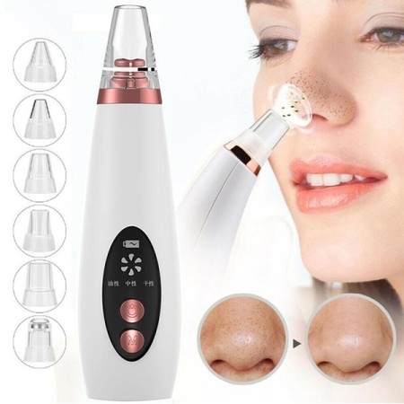 Blackhead Whitehead remover